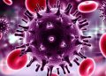 Acabando con la epidemia de SIDA