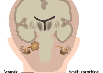 Ser más que un diagnóstico: Superando las barreras de la Neurofibromatosis tipo 2